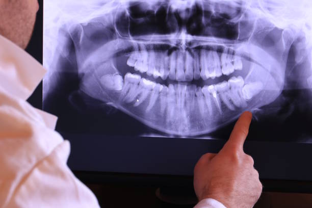 Best Emergency Treatment for Toothache in Agler Beach, FL