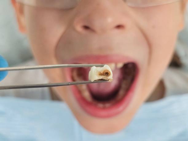 Best Emergency Orthodontic Repairs in Agler Beach, FL